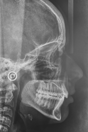 cirugía maxilofacial Málaga